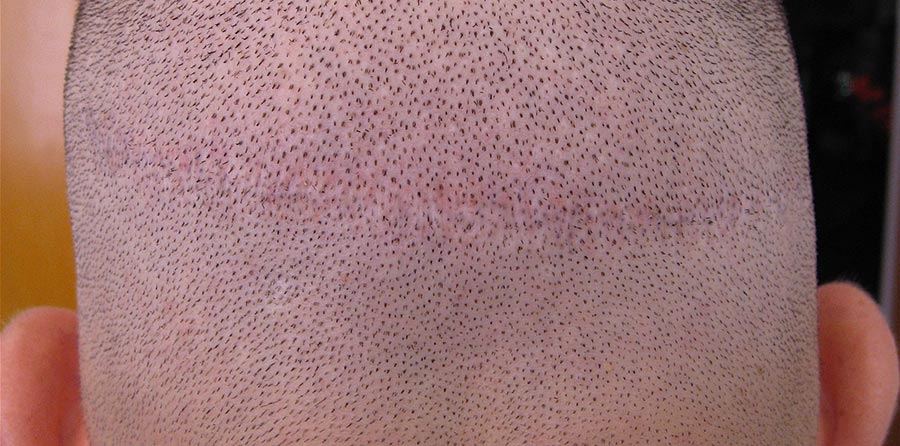 pigmentation