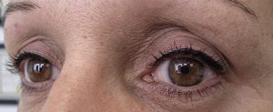 Yeux