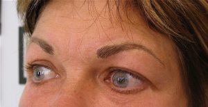 Yeux