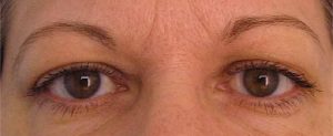 sourcils