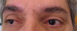 sourcils