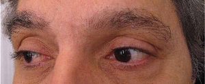 sourcils