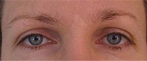 yeux