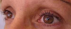 yeux