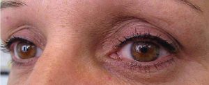 yeux