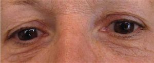 yeux