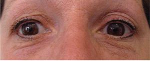 yeux