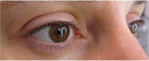 yeux