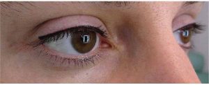 yeux