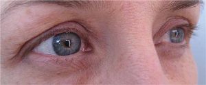 yeux