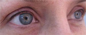 yeux