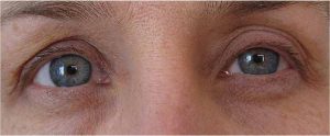 yeux