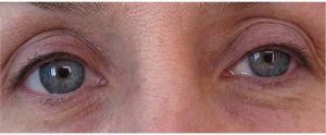 yeux