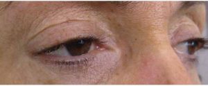 yeux