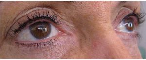 Sourcils